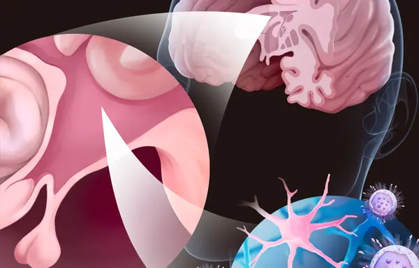 Nanocarriers crossing the blood-brain barrier